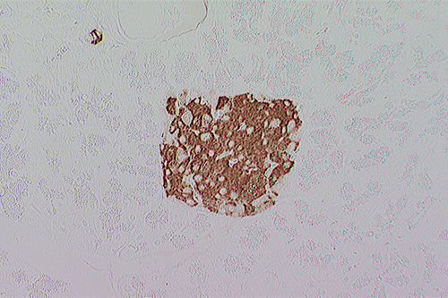 免疫組織化学染色（IHC）