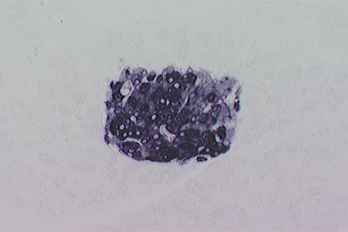In Situ Hybridization